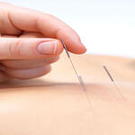 Traditional Chinese Massage